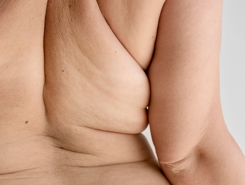 Maderoth&eacute;rapie